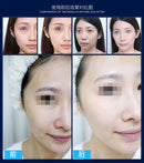 korea Vanadium Titanium Meso rejuvenescimento da pele meso arma de mesoterapia portátil máquina de mesoterapia sem agulha