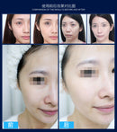 Vanadium Titanium Meso skin rejuvenation meso mesotherapy gun korea