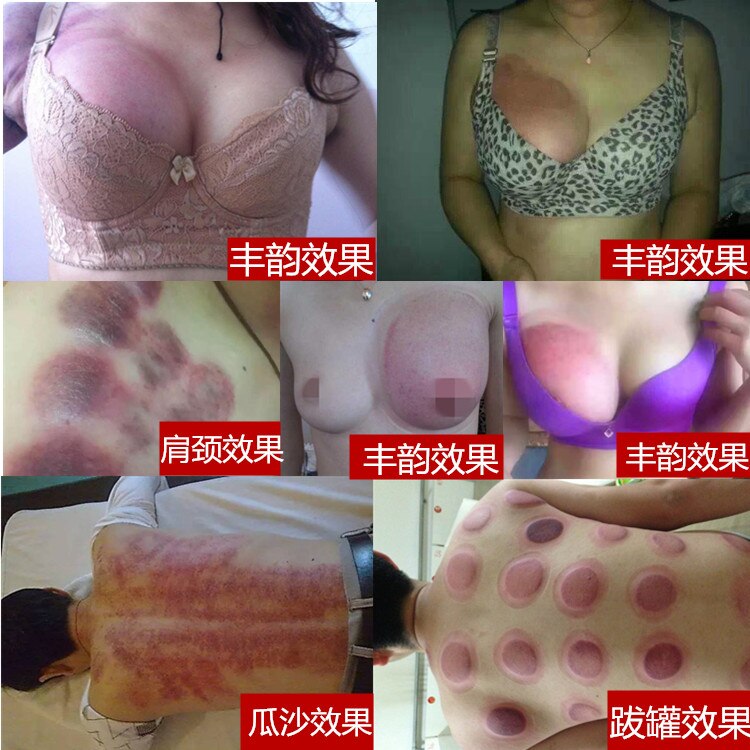 Próżniowa wzmocnienie piersi cupping filiżanki terapii Ustawianie piersi Powiększ masażer piersi