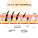 MiSMON MS-206B lézeres szőrtelenítő nőknek, IPL szőrtelenítő készülék férfiaknak/nőknek, tartós eredmények az arcon és a testen