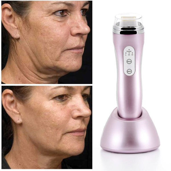 Nuevo Terapia de rejuvenecimiento de piel de RF Handy Mini Anti Envejecimiento Dot Matrix Cuidado de la piel RF Thermage Cuidado personal Dispositivo de belleza