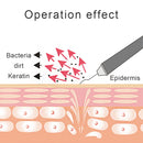 Kraftfull ultraljudsrengöring för ansiktshudskrubber Pormaskar, aknefläckar, borttagning av smuts i ansiktet