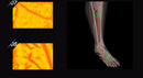 HD Vein imaging Vein Viewer Vein Finder Vein Camera Auxiliary Positioning Vein Tool