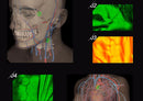 HD Vein imaging Vein Viewer Vein Finder Vein Camera Auxiliary Positioning Vein Tool