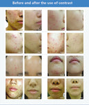 Професійний Photon PDT Led Light Facial Mask Machine 7 Colours Face Face Whitening Омолодження шкіри Світлотерапія