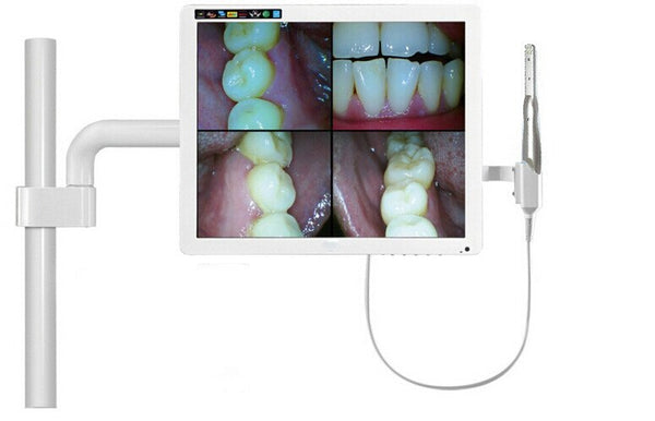 Câmera intraoral dental USB 2.0 dinâmico 4 mega pixels 6-liderado dentista intra endoscópio de câmera oral