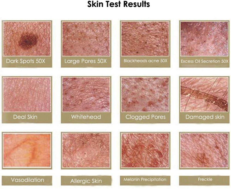 Spectrum Skin Test Facial Skin Analyzer Hair Analyser Machine Digital Dermoscopy Skin ...