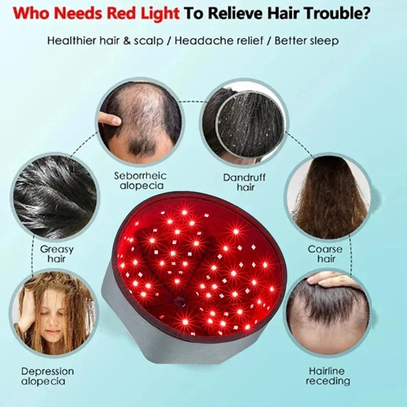 Tampa de crescimento do cabelo, dispositivos de terapia de luz vermelha, tratamento de perda de cabelo, capacete de recrescimento do cabelo, cuidados com o cabelo, melhoria anti-perda de cabelo