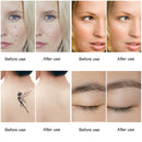 lescolton LS-058 La più recente penna laser a picosecondi lentiggine rimozione del tatuaggio talpa macchia scura sopracciglio pigmento laser macchina per l'acne cura della bellezza