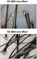 HD 200x 7 pollici LCD Pelle viso analizzatore per capelli analizzatore per capelli Digital Dermoscopy Pelle Analisi della pelle Rilevatore di pelle