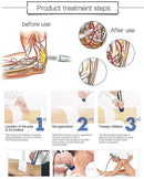 shockwave therapy machine