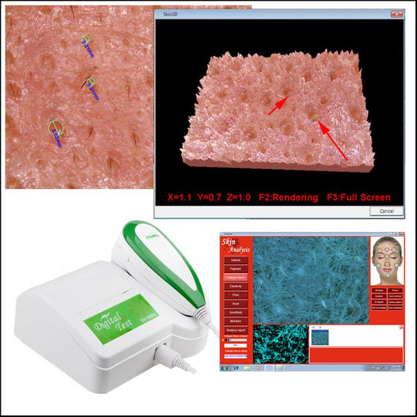 Detector analizador de piel facial HD de 5 millones de píxeles Alcance de la piel Humedad del acné graso Análisis completo de la piel para spa de belleza