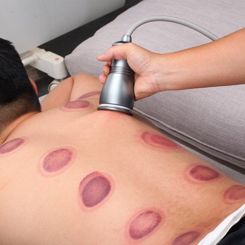 Elektrisk skrapning Gua Sha Ventosas Anticelluliter Fettförbrännare Koppning Kroppsbantning Massager Vibrerande Meridian Mudder Guasha