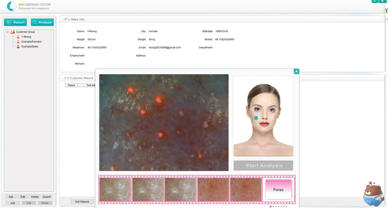 Sistema di cura del viso con pixel ad alta definizione Funzionamento intelligente Diagnosi automatica Analizzatore della pelle del derma dell'epidermide facciale