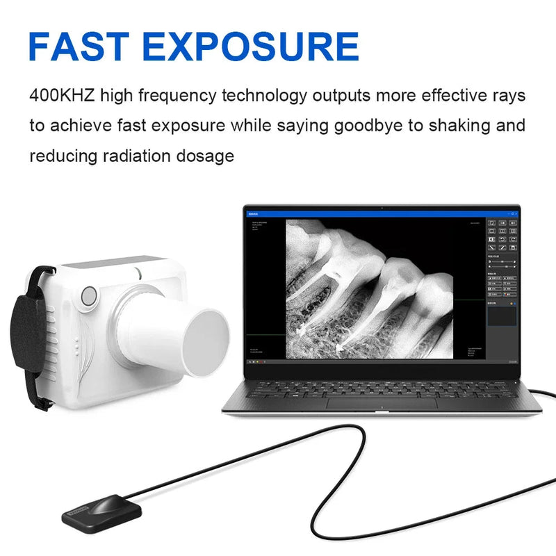 Conjunto intraoral portátil dental do sensor do raio x rayer no sistema de imagem digital handheld cineasta máquina de raio x