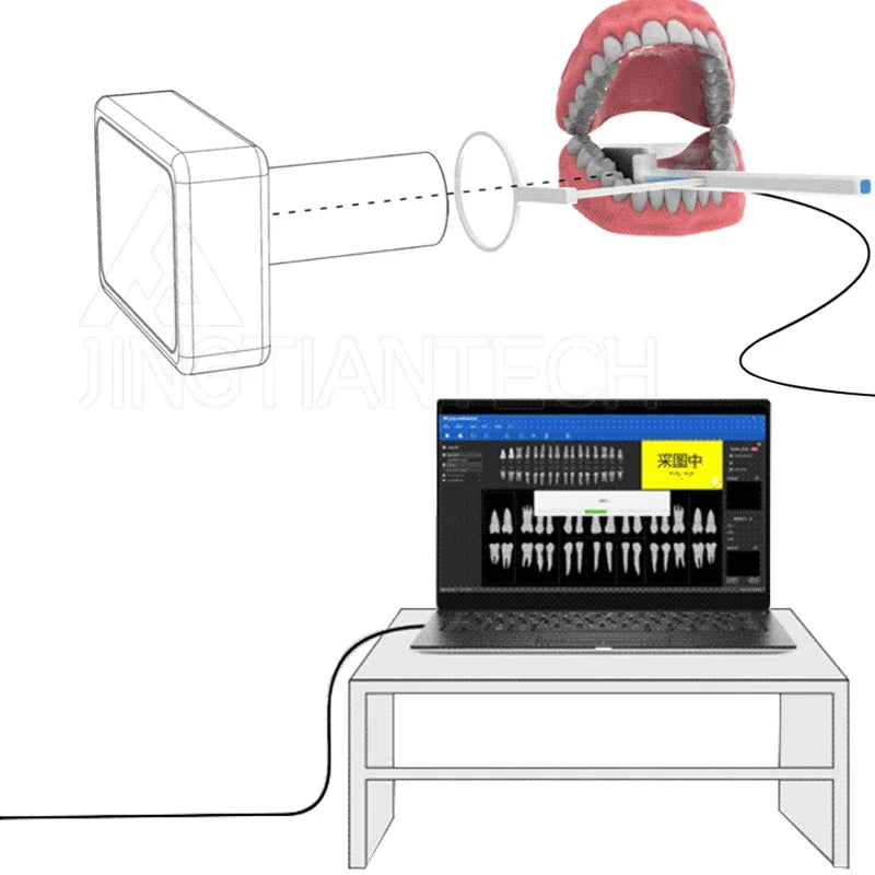 Rangkaian Sensor Mulut X-ray Rayer Portabel Gigi Dalam Sistem Pencitraan Digital Pembuat Film Genggam Mesin X-ray Set Intraoral
