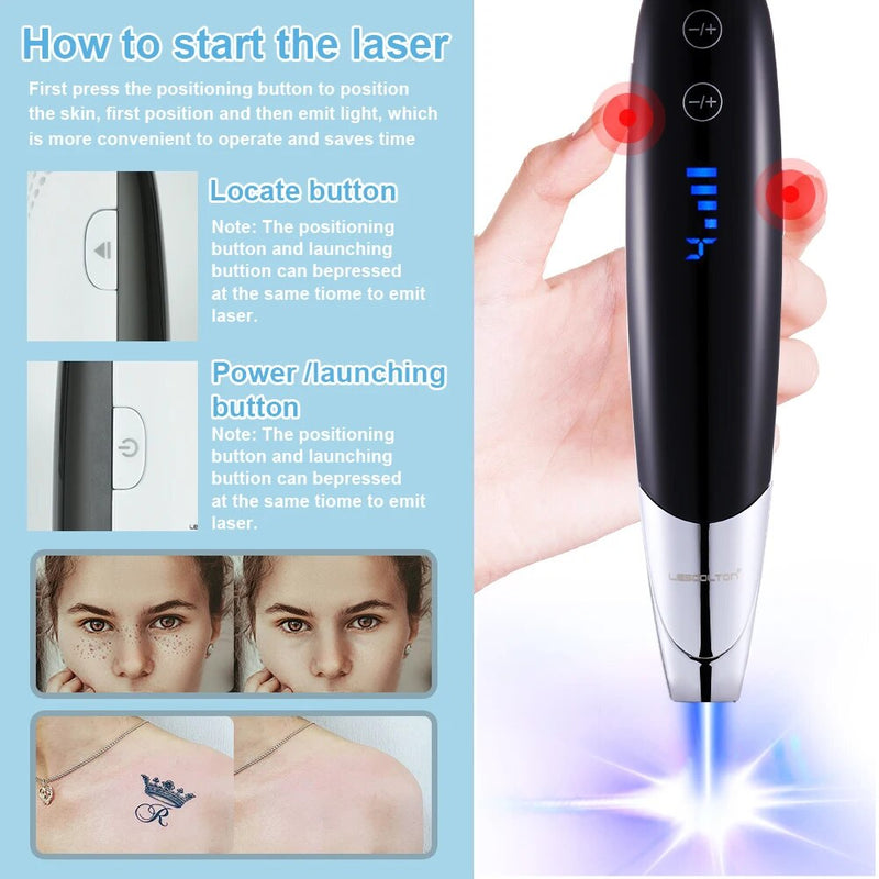 Laser Picosecond Pen Lentiggine Rimozione del tatuaggio Mirando al bersaglio Individuare la posizione Talpa Spot Sopracciglio Rimozione del pigmento Strumento di bellezza per l'acne