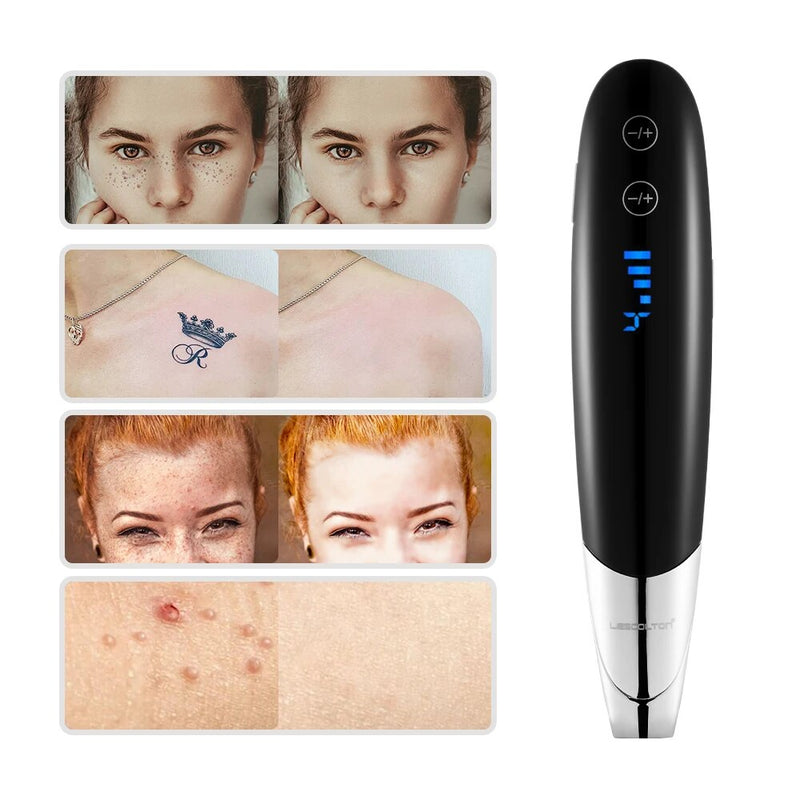 MY-035 Portable Spot Remover Pen USB Rechargeable Skin Tag Tattoo Removal  Tool Kit With 6