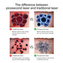 Lescolton Laser Picosecond Pen Tattoo Talpa Verruca Lentiggine Macchina per la rimozione della melanina Cicatrici Dispositivo di rimozione della pelle morta Penna laser Dispositivi di bellezza