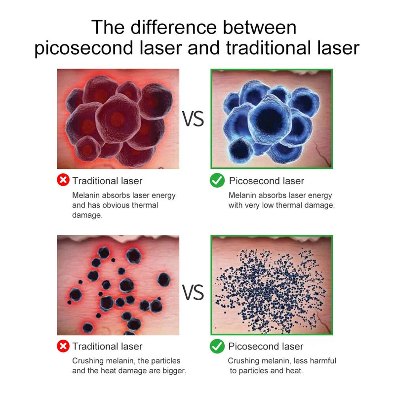 Lescolton Picosecond Laser Pen Terapi Cahaya Biru Tatu Tahi Lalat Penghapusan Jeragat Mesin Penghilang Tompok Gelap Peranti Kecantikan Kegunaan Rumah