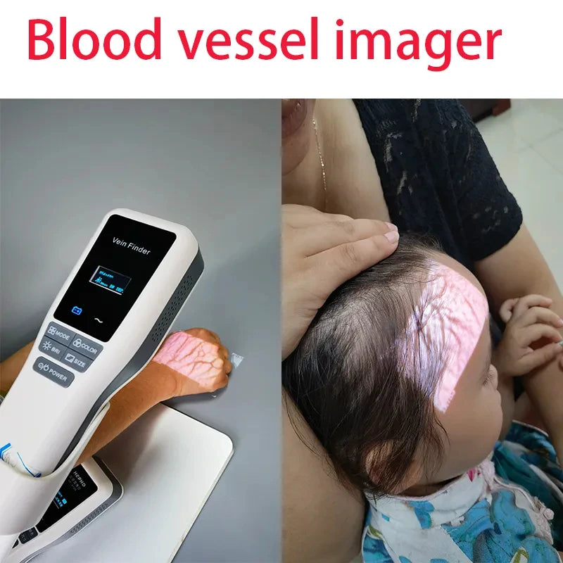 HF-410A Medical Beauty Salon Face Vein Locator Aesthetic Clinic Use Handheld Infrared Vein Viewer Finder