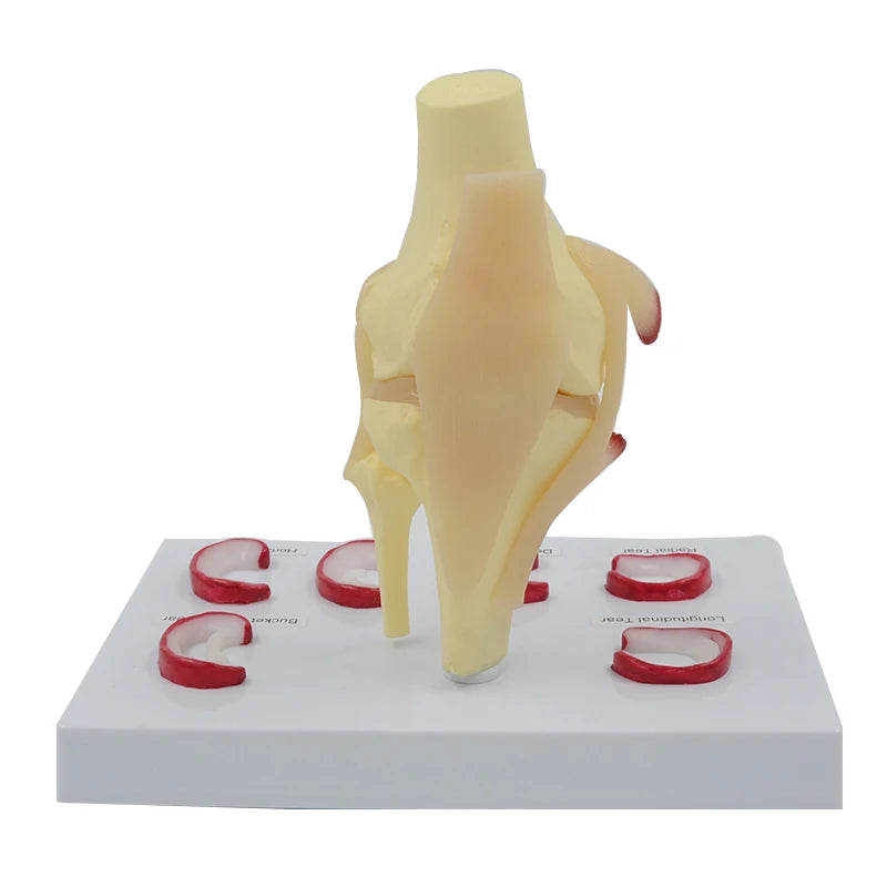Modelo de sutura de menisco, tamanho real, demilune humano, ferramenta de ensino de ciências médicas, modelo anatômico