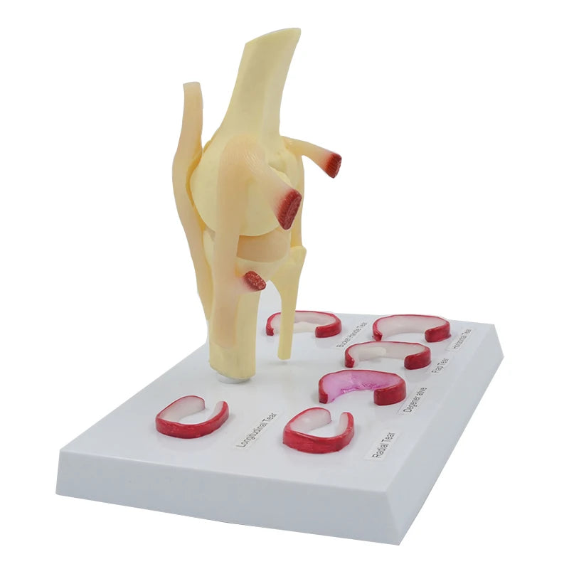 Meniscus Modeled Meniscus Suture Model Life Size Human Demilune Menisci Medical Science ...