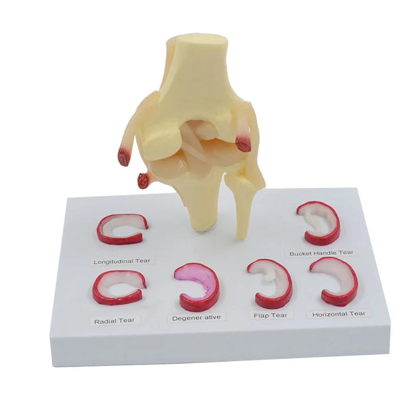 Modelo de sutura de menisco, tamaño real, menisco humano Demilune, herramienta de enseñanza de ciencia médica, modelo anatómico