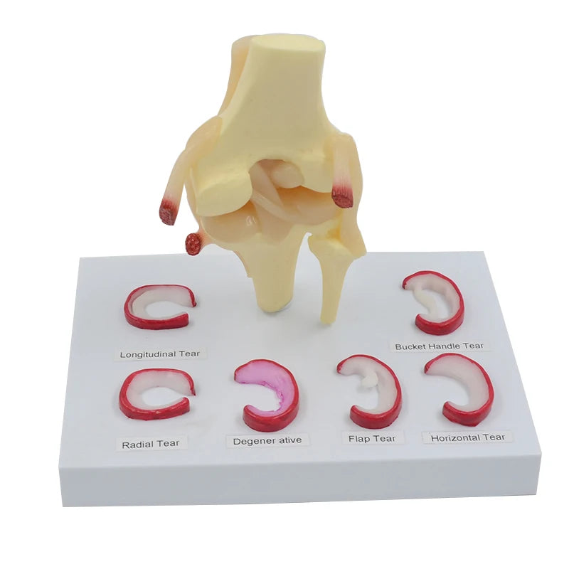 Meniscus Modeled Meniscus Suture Model Life Size Human Demilune Menisci Medical Science ...