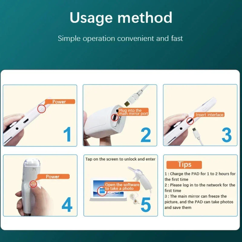 Mini colposcópio com vídeo digital para monitoramento de saúde preciso e conveniente Monitores opcionais Acessórios de autoteste