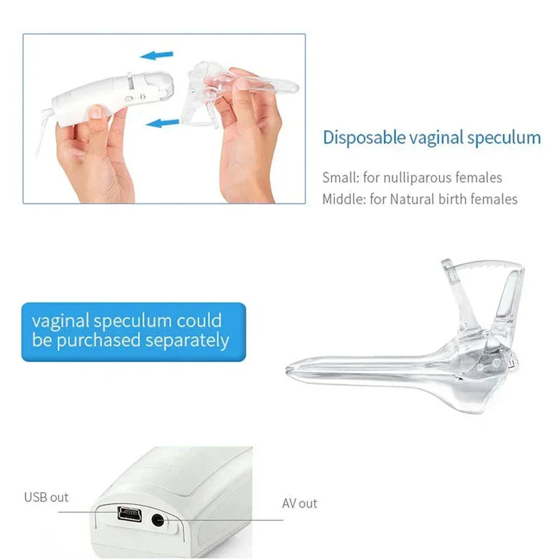 Mini Colposcope with Digital Video for Accurate and Convenient Health Monitoring Optional Monitors Self-testing Accessories