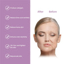 Mini hifu ultrassom vibração rosto máquina de aperto da pele portátil rf dispositivo de levantamento de rosto anti-envelhecimento dispositivo de tonificação facial