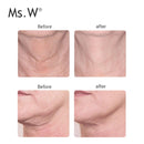 Ms.W New Home-Use 5 f'1 Kura tal-ġilda Anti-aging Face &amp; Neck Lifting Massager Għodod tas-sbuħija Face Massager Tbaħħir liberu