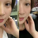 Caneta de plasma multifuncional para levantamento de rugas e pálpebras, caneta de plasma para spa e salão de beleza ce