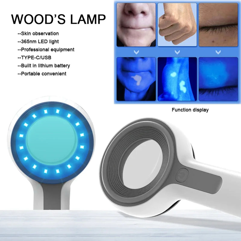 NEW Woods Lamp Skin Analyzer לעור UV הגדלה ליופי בדיקת פנים עץ מנורת עץ ניתוח זיהוי ניתוח עור טיפוח העור