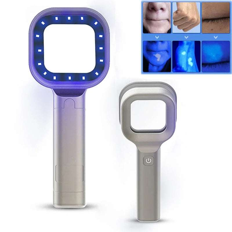 Új bőranalizátor Woods lámpával, hordozható vitiligo detektor bőrelemző gép, újratölthető bőrfelismerő fafény lámpa