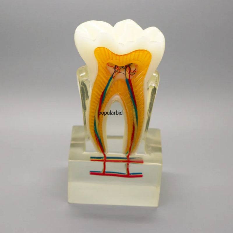 דגם אורתודונטי 6:1 שיניים הוראה עם עצב בסיס ברור הדגמת דיסקציה אנטומית של רופא שיניים אנדודונט