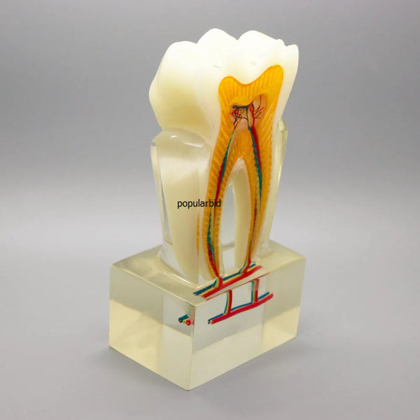 Modelo de ortodoncia 6:1, enseñanza de dientes con base clara, demostración de disección anatómica del nervio, dentista, endodoncia
