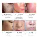 PDT Facial LED Máscara Facial 6 Cores Luz Fototerapia Máquina Terapia de Calor Anti Envelhecimento Remoção de Pontos de Acne Dispositivo de Rejuvenescimento da Pele