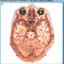 Professionell 3d Nls hälsoanalysator med CE