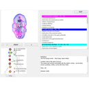 Profesional Metapathia GR 8D 25D NLS Penganalisis Kesihatan Badan Kuantum Bioresonans Metatron 4025 Peranti Pengimbas Biofeedback