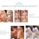 Microdermabrasion Profesional 6 Dalam 1 Air Oksigen Penjagaan Kulit Pembersihan Dalam Hydra Dermabrasion Mesin Muka Air Aqua Pengelupasan