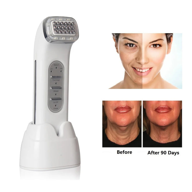 Radiofrequency Facial RF Radio Frequency Lifting Face Lift Body SKin anti Wrinkle Removal Skin Tightening Beauty