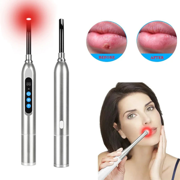 Appareil de thérapie à la lumière rouge sans fil, LED proche infrarouge des boutons de fièvre et des chancres, soulagement de la douleur, soins de la peau, baguette de beauté