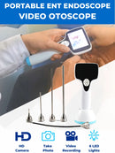 Skop Telinga Perubatan Besdata HD Otoskop Perubatan Digital Otoscopio ENT endoskopi