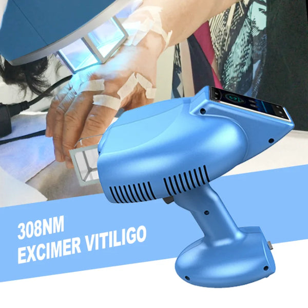 אקצימר לייזר 308 ננומטר טיפול יעיל במחלות עור ויטיליגו קיור כף יד מנורת 308 ננומטר