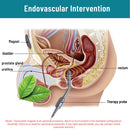 Prostate Physiotherapy Massager