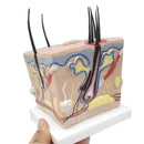 Model kulit kepala rambut rontok transplantasi rambut peradangan folikel rambut saraf kapiler model pengajaran