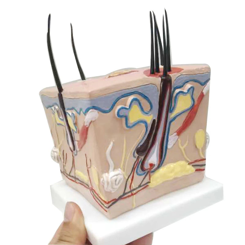 Model kulit kepala rambut rontok transplantasi rambut model pengajaran peradangan folikel rambut saraf kapiler