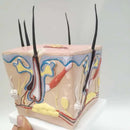 Model kulit kepala rambut rontok transplantasi rambut peradangan folikel rambut saraf kapiler model pengajaran